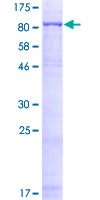 12.5% SDS-PAGE Stained with Coomassie Blue.
